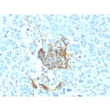 Immunohistochemistry - Anti-p75 NGF Receptor Antibody [NGFR/1964] - BSA and Azide free (A252683) - Antibodies.com