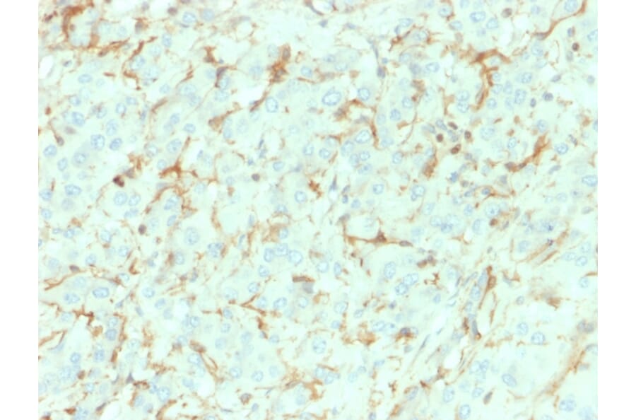 Immunohistochemistry - Anti-p75 NGF Receptor Antibody [NGFR/1964] - BSA and Azide free (A252683) - Antibodies.com