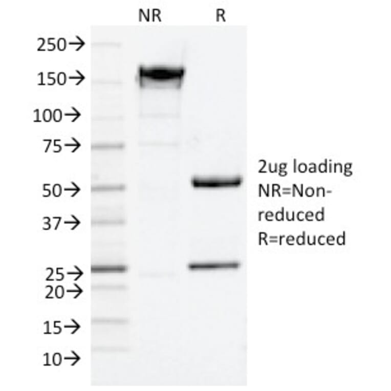 SDS-PAGE - Anti-p75 NGF Receptor Antibody [NGFR/1964] - BSA and Azide free (A252683) - Antibodies.com