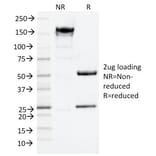 SDS-PAGE - Anti-p75 NGF Receptor Antibody [NGFR/1964] - BSA and Azide free (A252683) - Antibodies.com