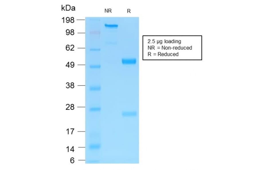 SDS-PAGE - Anti-p75 NGF Receptor Antibody [NGFR/1997R] - BSA and Azide free (A252684) - Antibodies.com
