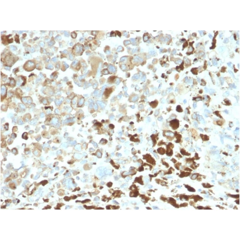 Immunohistochemistry - Anti-p75 NGF Receptor Antibody [NGFR/2550R] - BSA and Azide free (A252684) - Antibodies.com