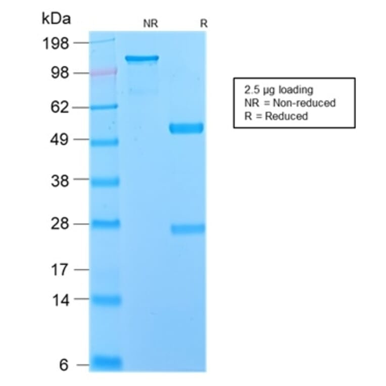 SDS-PAGE - Anti-p75 NGF Receptor Antibody [NGFR/2550R] - BSA and Azide free (A252685) - Antibodies.com