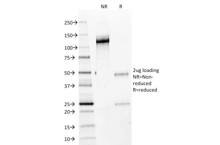 SDS-PAGE - Anti-NKX2.2 Antibody [NX2/294] - BSA and Azide free (A252686) - Antibodies.com