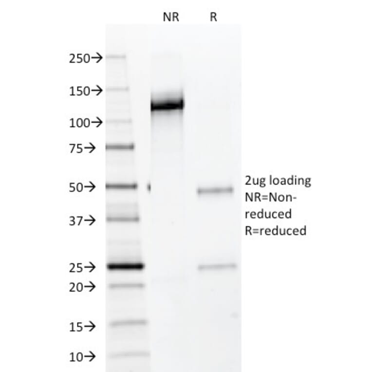 SDS-PAGE - Anti-NKX2.2 Antibody [NX2/294] - BSA and Azide free (A252686) - Antibodies.com