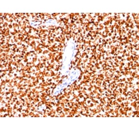 Immunohistochemistry - Anti-NKX2.2 Antibody [SPM564] - BSA and Azide free (A252686) - Antibodies.com
