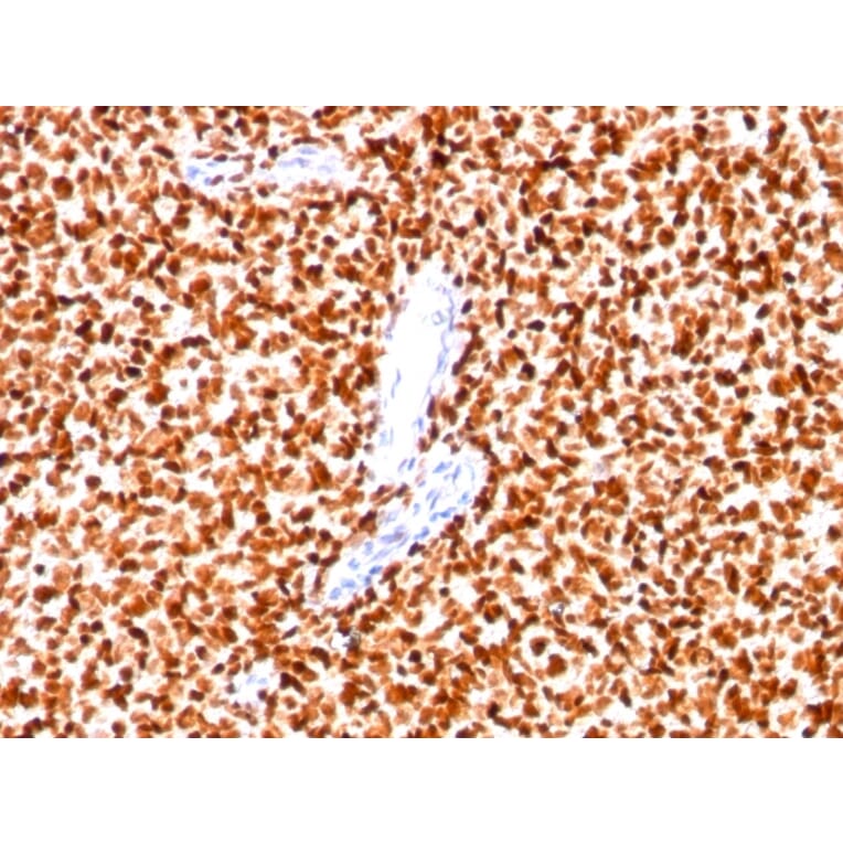 Immunohistochemistry - Anti-NKX2.2 Antibody [SPM564] - BSA and Azide free (A252686) - Antibodies.com