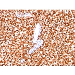 Immunohistochemistry - Anti-NKX2.2 Antibody [SPM564] - BSA and Azide free (A252686) - Antibodies.com