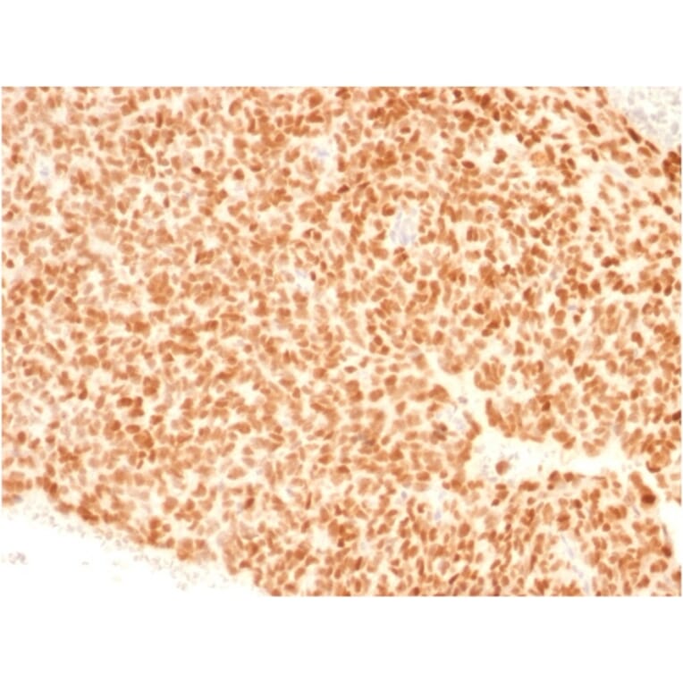 Immunohistochemistry - Anti-NKX2.2 Antibody [NX2/1523] - BSA and Azide free (A252688) - Antibodies.com