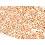 Immunohistochemistry - Anti-NKX2.2 Antibody [NX2/1523] - BSA and Azide free (A252688) - Antibodies.com