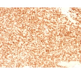 Immunohistochemistry - Anti-NKX2.2 Antibody [NX2/1524] - BSA and Azide free (A252689) - Antibodies.com