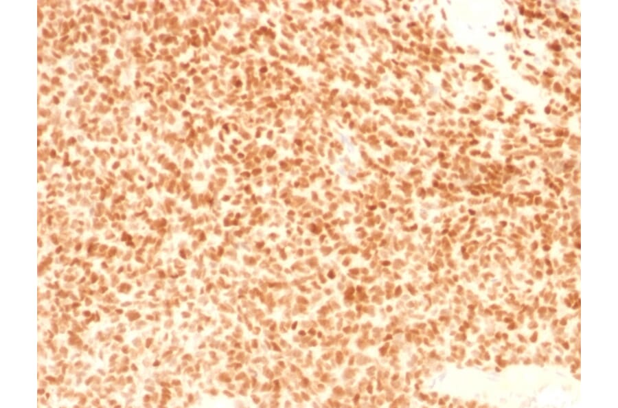 Immunohistochemistry - Anti-NKX2.2 Antibody [NX2/1524] - BSA and Azide free (A252689) - Antibodies.com