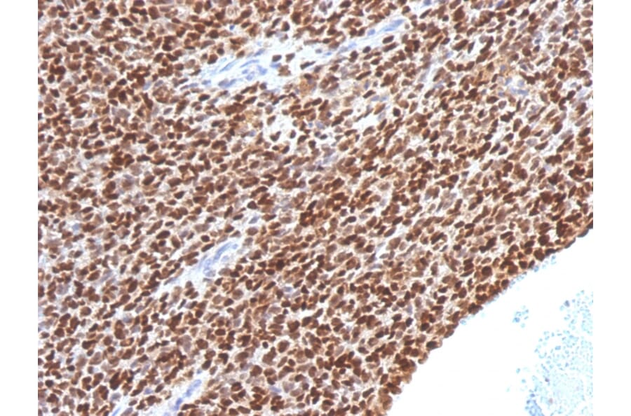 Immunohistochemistry - Anti-NKX2.2 Antibody [NX2/1524] - BSA and Azide free (A252689) - Antibodies.com