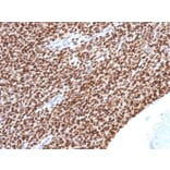 Immunohistochemistry - Anti-NKX2.2 Antibody [NX2/1524] - BSA and Azide free (A252689) - Antibodies.com