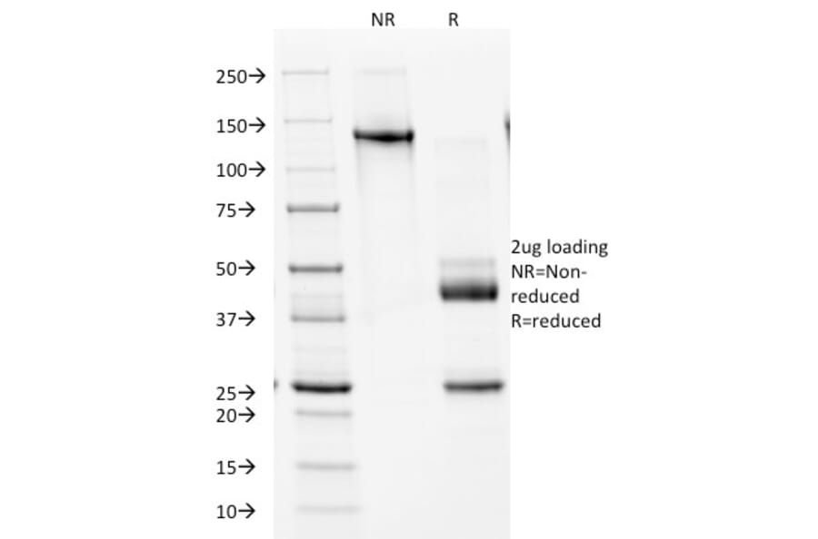 SDS-PAGE - Anti-NKX2.2 Antibody [NX2/1524] - BSA and Azide free (A252689) - Antibodies.com