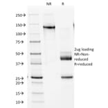 SDS-PAGE - Anti-NKX2.2 Antibody [NX2/1524] - BSA and Azide free (A252689) - Antibodies.com