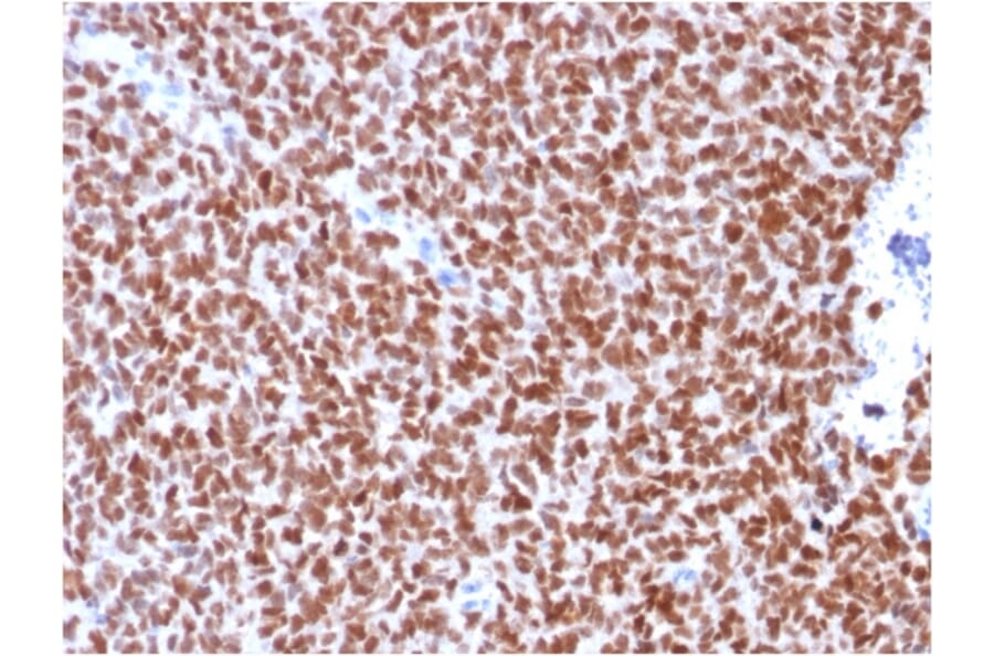 Immunohistochemistry - Anti-NKX2.2 Antibody [rNX2/294] - BSA and Azide free (A252690) - Antibodies.com