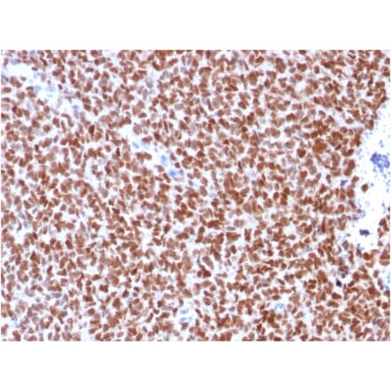Immunohistochemistry - Anti-NKX2.2 Antibody [rNX2/294] - BSA and Azide free (A252690) - Antibodies.com