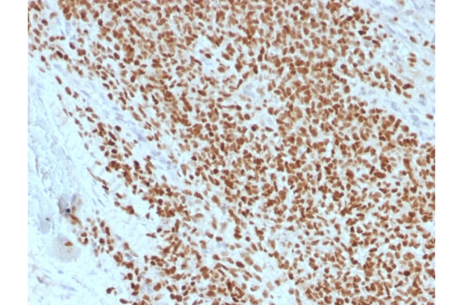 Immunohistochemistry - Anti-NKX2.2 Antibody [rNX2/1523] - BSA and Azide free (A252690) - Antibodies.com