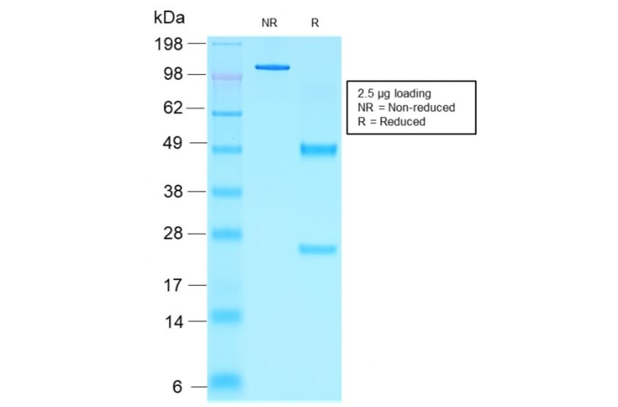 SDS-PAGE - Anti-NKX2.2 Antibody [rNX2/1523] - BSA and Azide free (A252691) - Antibodies.com