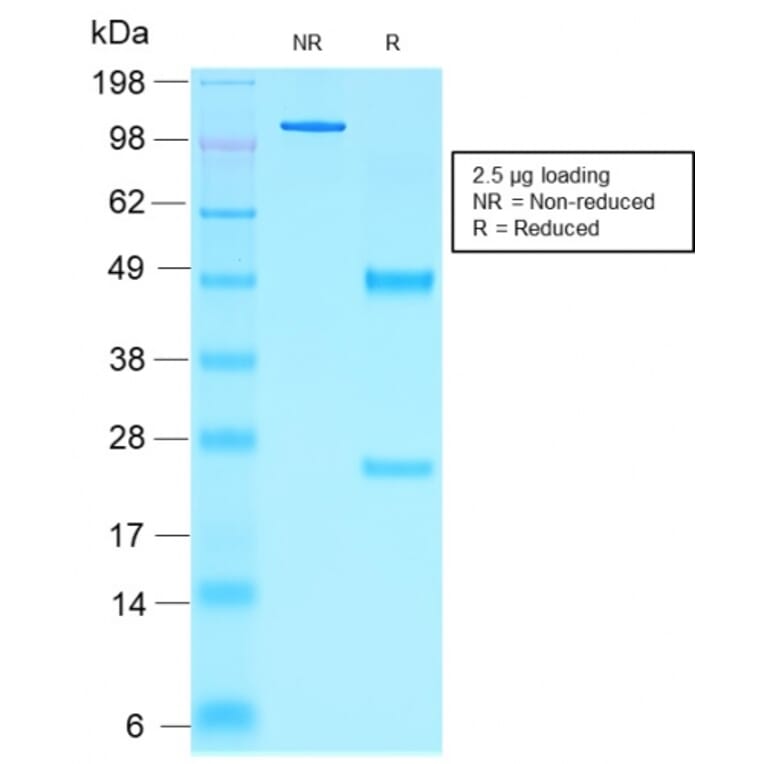 SDS-PAGE - Anti-NKX2.2 Antibody [rNX2/1523] - BSA and Azide free (A252691) - Antibodies.com