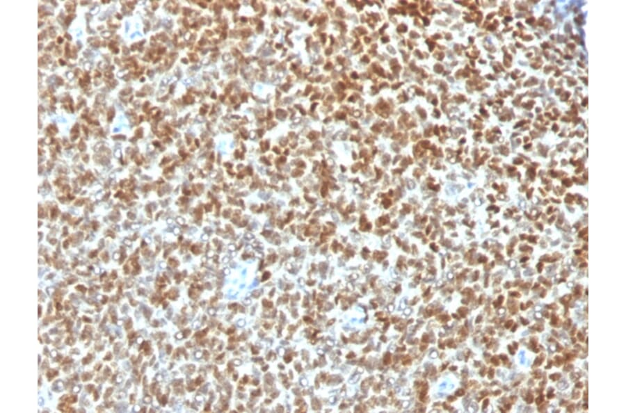 Immunohistochemistry - Anti-NKX2.2 Antibody [NX2/1422R] - BSA and Azide free (A252691) - Antibodies.com