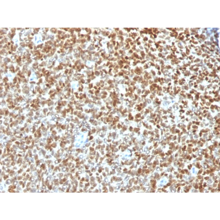 Immunohistochemistry - Anti-NKX2.2 Antibody [NX2/1422R] - BSA and Azide free (A252691) - Antibodies.com