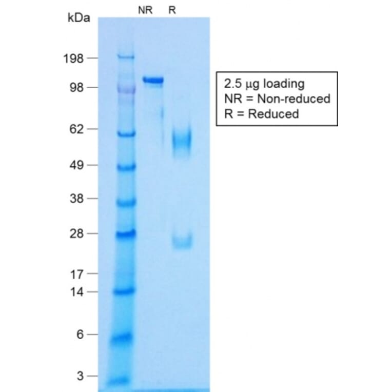 SDS-PAGE - Anti-NKX2.2 Antibody [NX2/1422R] - BSA and Azide free (A252692) - Antibodies.com