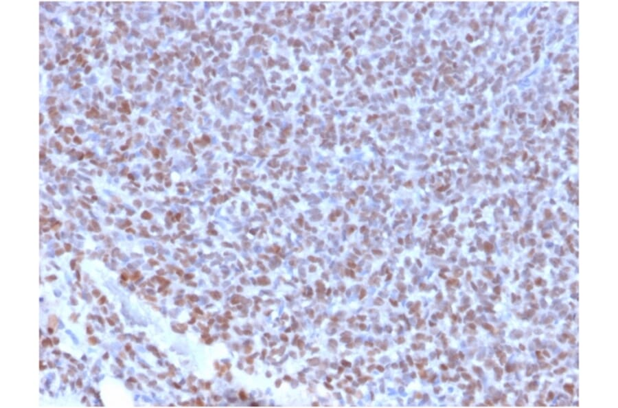 Immunohistochemistry - Anti-NKX2.2 Antibody [NX2/2198R] - BSA and Azide free (A252692) - Antibodies.com