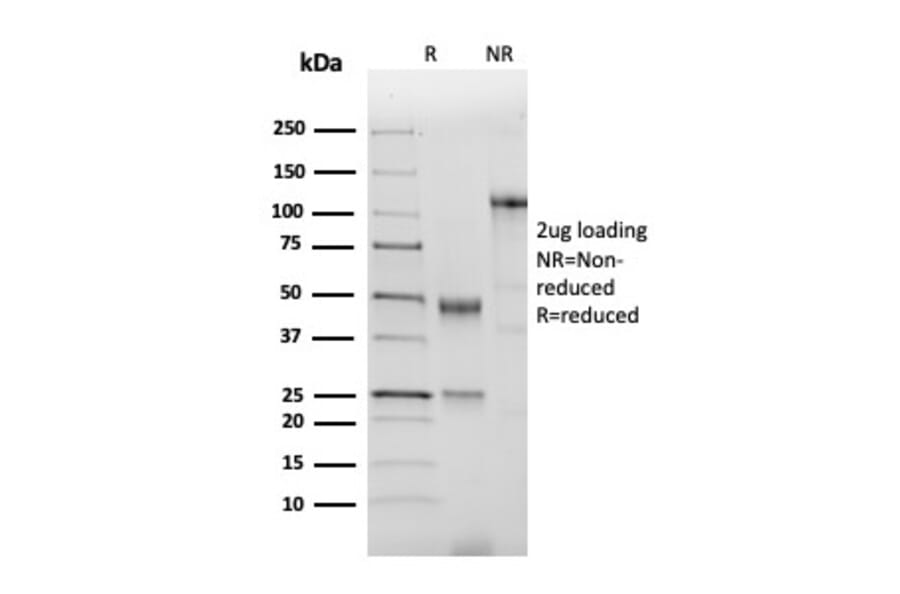SDS-PAGE - Anti-NKX2.2 Antibody [NX2/2198R] - BSA and Azide free (A252693) - Antibodies.com
