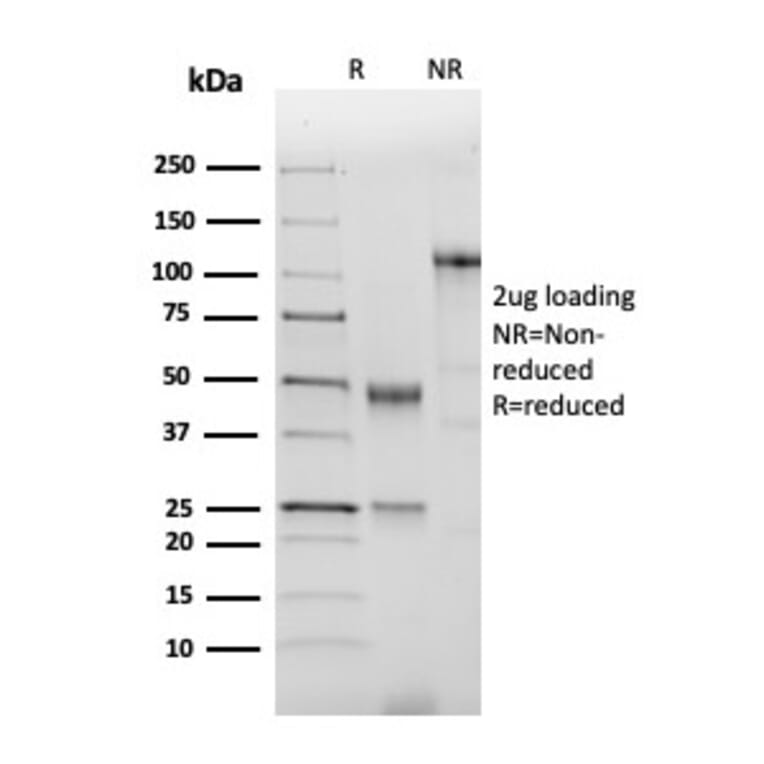 SDS-PAGE - Anti-NKX2.2 Antibody [NX2/2198R] - BSA and Azide free (A252693) - Antibodies.com