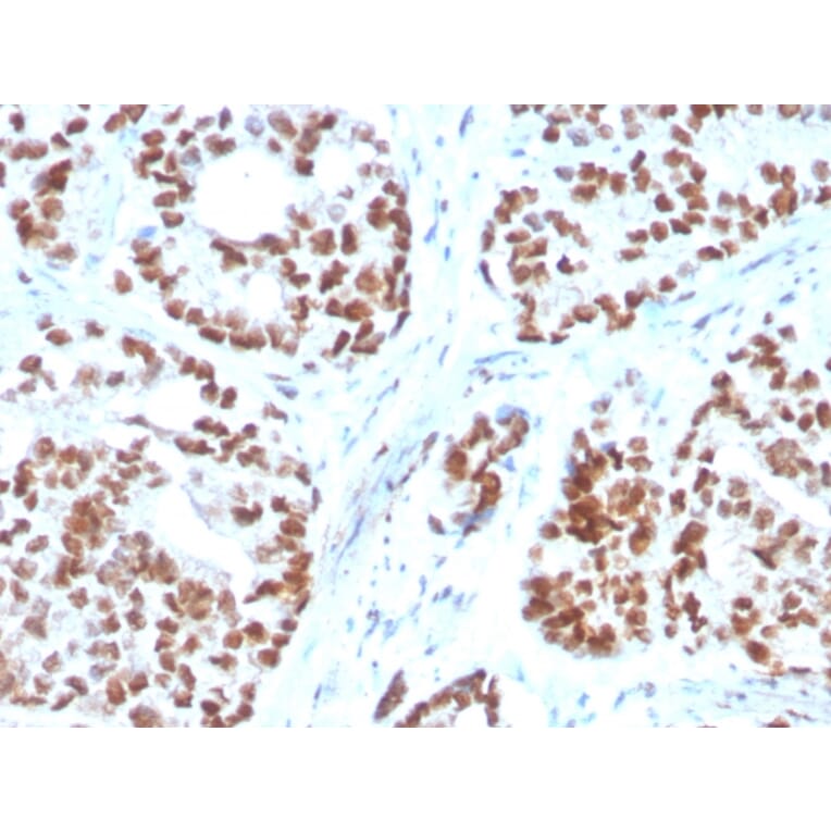 Immunohistochemistry - Anti-NKX3.1 Antibody [NKX3.1/3350] - BSA and Azide free (A252695) - Antibodies.com
