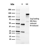 SDS-PAGE - Anti-NKX3.1 Antibody [NKX3.1/3350] - BSA and Azide free (A252695) - Antibodies.com