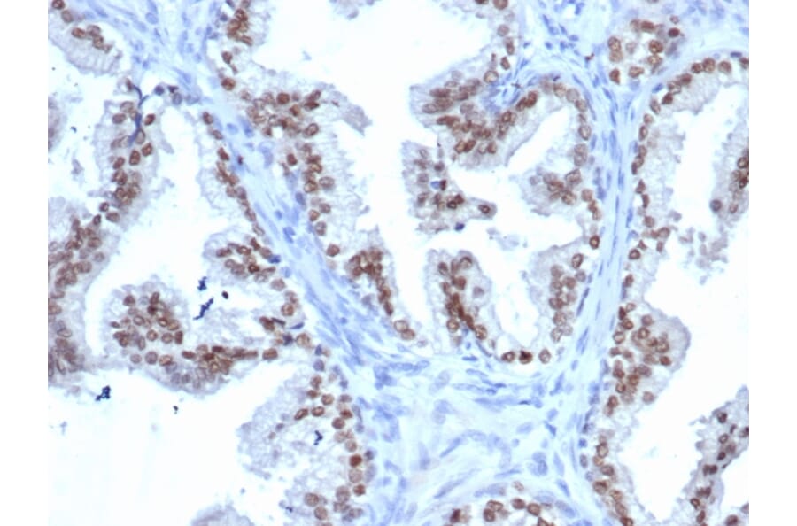 Immunohistochemistry - Anti-NKX3.1 Antibody [rNKX3.1/6620] - BSA and Azide free (A252695) - Antibodies.com