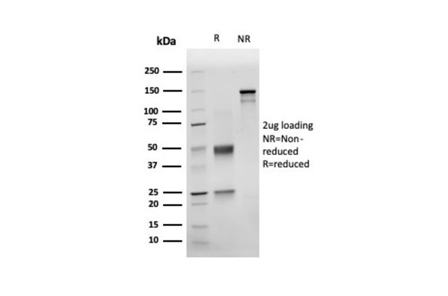 SDS-PAGE - Anti-NKX3.1 Antibody [rNKX3.1/6620] - BSA and Azide free (A252696) - Antibodies.com