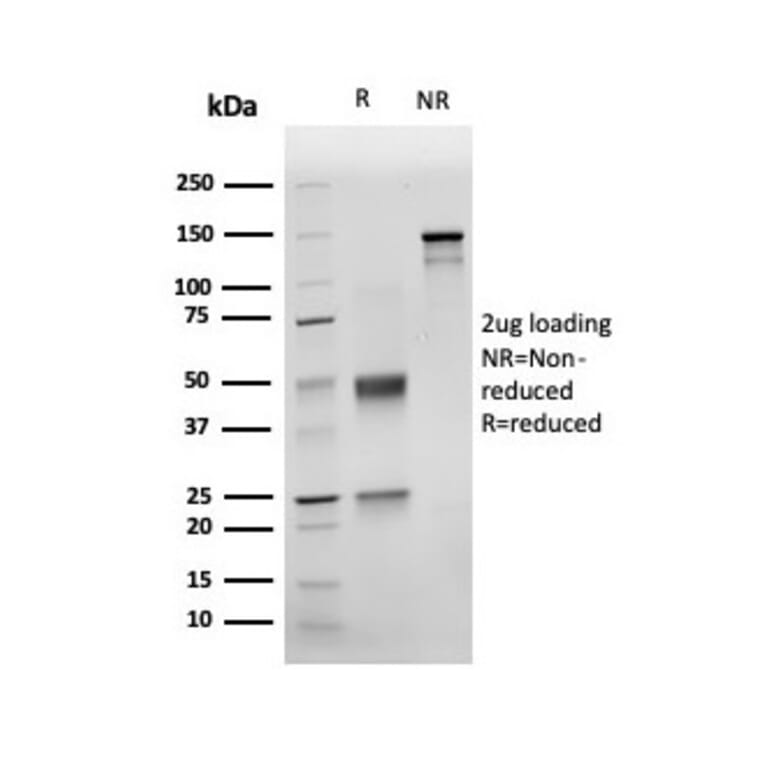 SDS-PAGE - Anti-NKX3.1 Antibody [rNKX3.1/6620] - BSA and Azide free (A252696) - Antibodies.com
