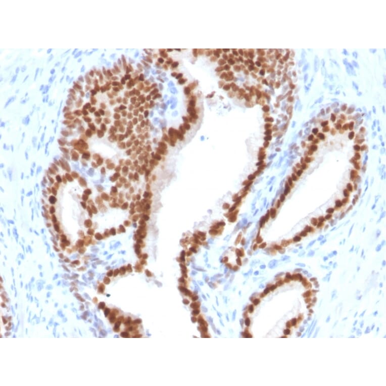 Immunohistochemistry - Anti-NKX3.1 Antibody [NKX3.1/2576] - BSA and Azide free (A252697) - Antibodies.com