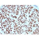 Immunohistochemistry - Anti-NKX3.1 Antibody [NKX3.1/2576] - BSA and Azide free (A252697) - Antibodies.com