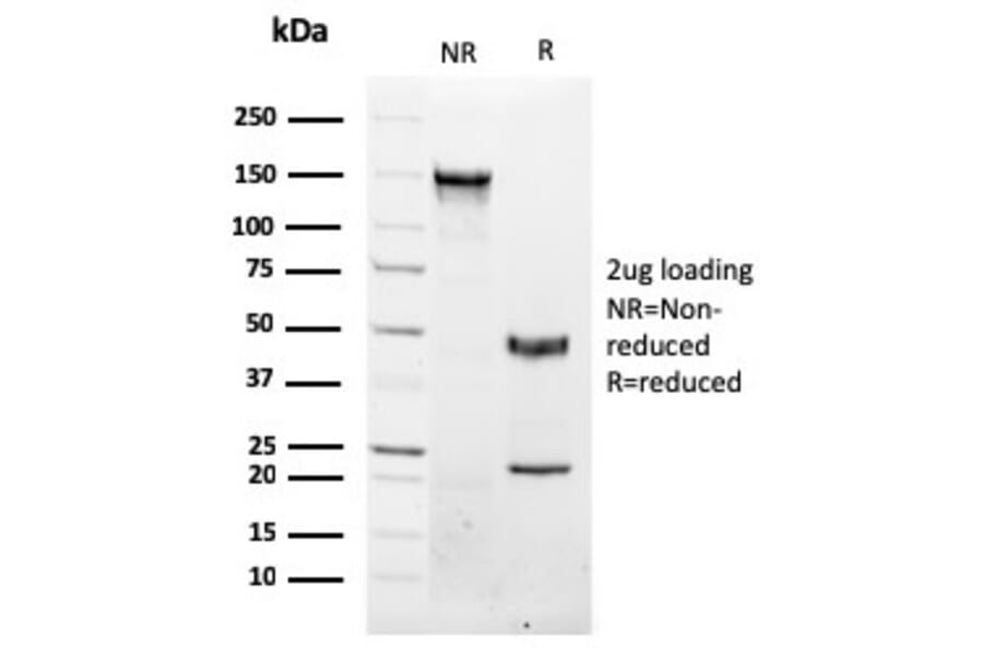SDS-PAGE - Anti-NKX3.1 Antibody [NKX3.1/2576] - BSA and Azide free (A252697) - Antibodies.com