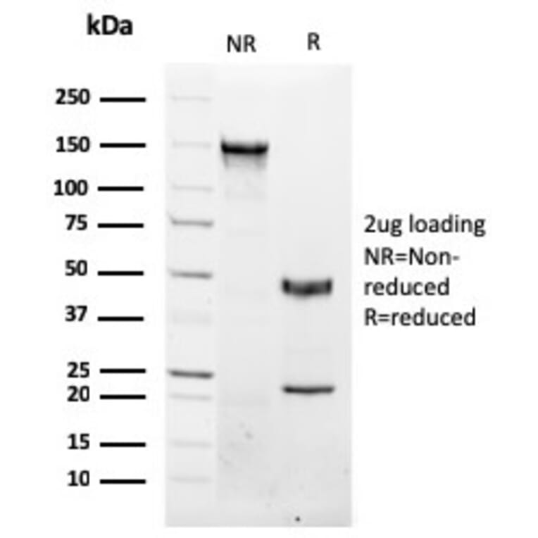 SDS-PAGE - Anti-NKX3.1 Antibody [NKX3.1/2576] - BSA and Azide free (A252697) - Antibodies.com