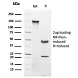 SDS-PAGE - Anti-NKX3.1 Antibody [NKX3.1/2576] - BSA and Azide free (A252697) - Antibodies.com