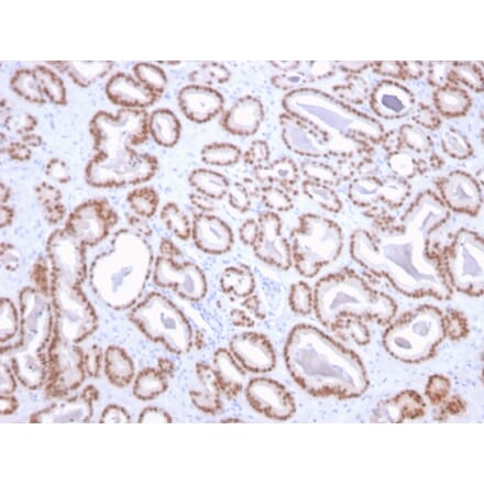 Immunohistochemistry - Anti-NKX3.1 Antibody [NKX3.1/2836] - BSA and Azide free (A252698) - Antibodies.com