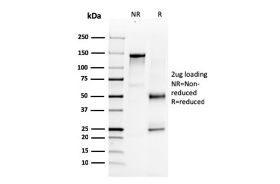 SDS-PAGE - Anti-NKX3.1 Antibody [NKX3.1/3347] - BSA and Azide free (A252699) - Antibodies.com