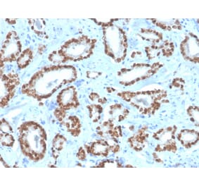 Immunohistochemistry - Anti-NKX3.1 Antibody [NKX3.1/4562R] - BSA and Azide free (A252701) - Antibodies.com