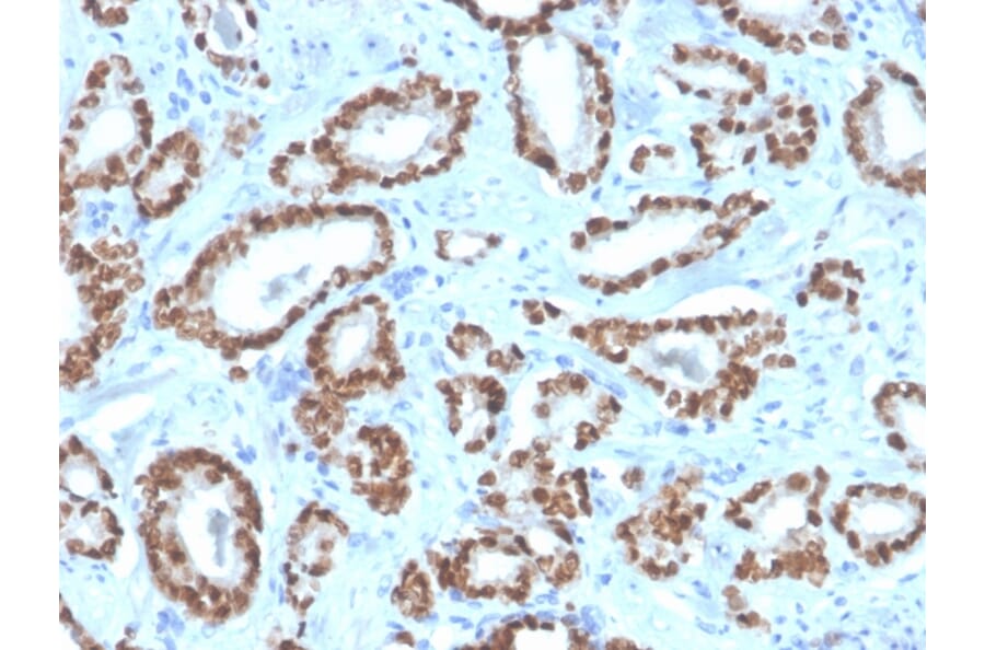 Immunohistochemistry - Anti-NKX3.1 Antibody [NKX3.1/4562R] - BSA and Azide free (A252701) - Antibodies.com
