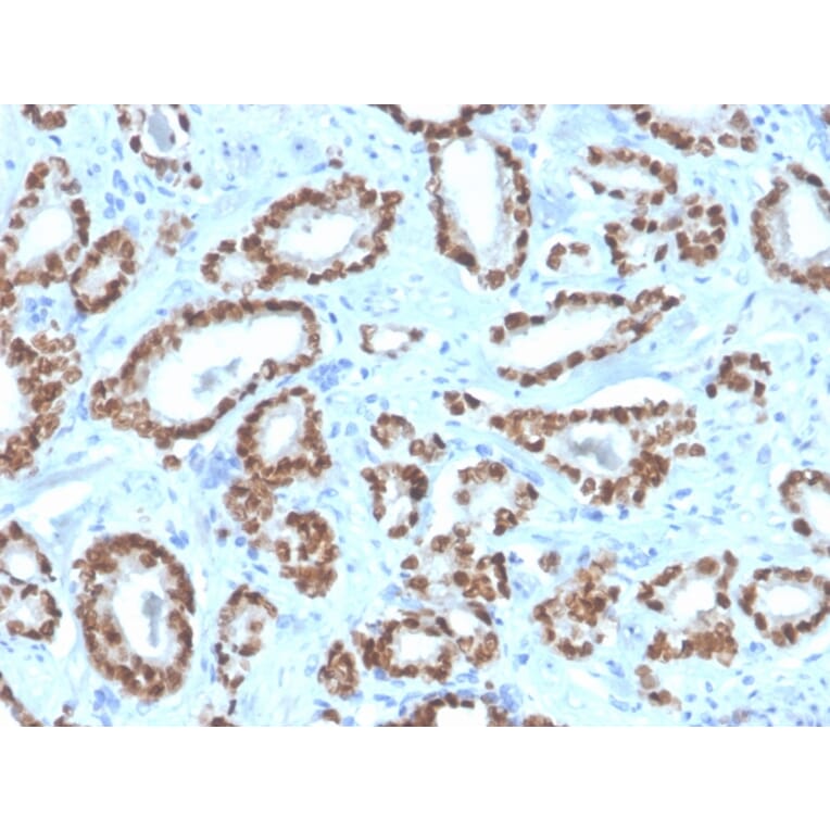 Immunohistochemistry - Anti-NKX3.1 Antibody [NKX3.1/4562R] - BSA and Azide free (A252701) - Antibodies.com
