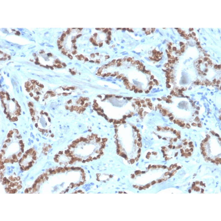 Immunohistochemistry - Anti-NKX3.1 Antibody [NKX3.1/4562R] - BSA and Azide free (A252700) - Antibodies.com
