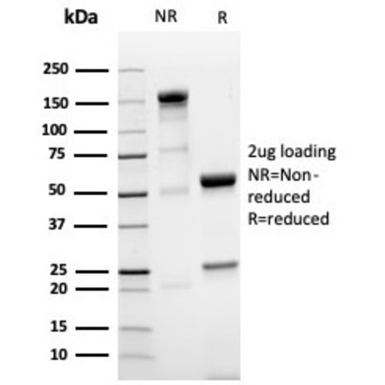 SDS-PAGE - Anti-NKX3.1 Antibody [NKX3.1/4562R] - BSA and Azide free (A252701) - Antibodies.com