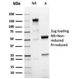 SDS-PAGE - Anti-NKX3.1 Antibody [NKX3.1/4562R] - BSA and Azide free (A252701) - Antibodies.com