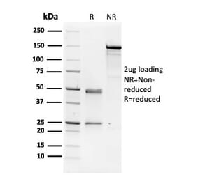 SDS-PAGE - Anti-NME1 Antibody [CPTC-NME1-2] - BSA and Azide free (A252702) - Antibodies.com